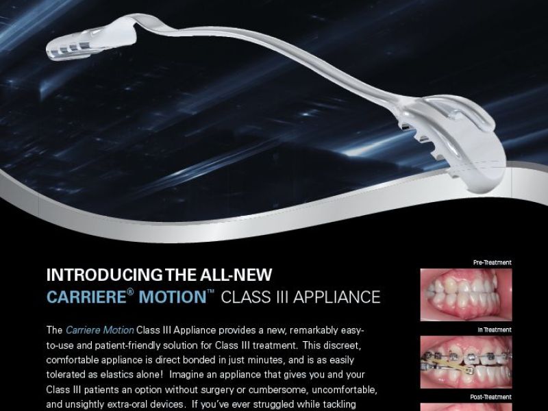 Carriere Motion Class III Appliance
