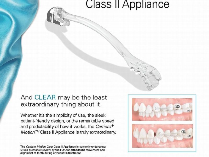 Carriere Motion Clear Class II Appliance