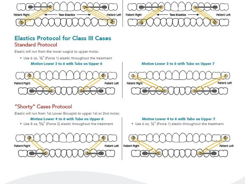 Carriere Motion Elastics Protocols